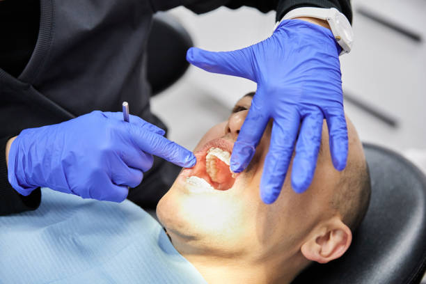 Best Emergency Treatment for Toothache in Park Falls, WI